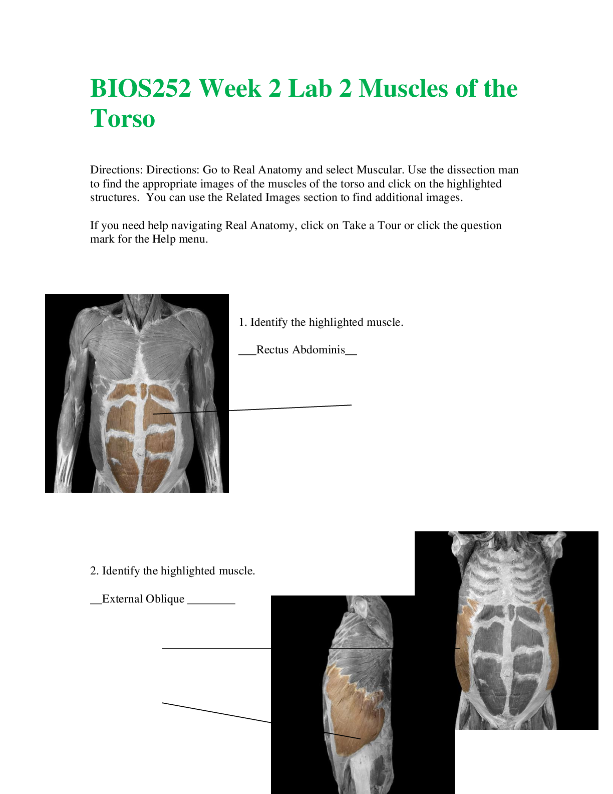Preview of BIOS252 Week 2 Lab 2 Muscles of the Torso (Complete 100% Correct)